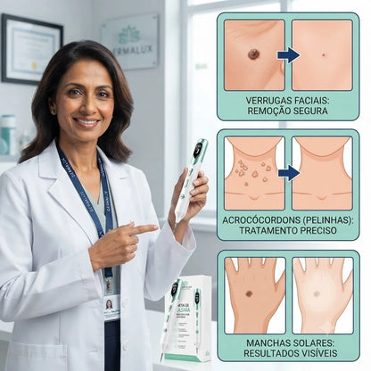 Dermalux Pro - Caneta Plasma Removedora de Verrugas e Manchas